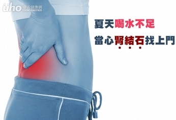 夏天喝水不足 當心腎結石找上門