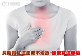 長期胃食道逆流不治療 恐致食道腺癌