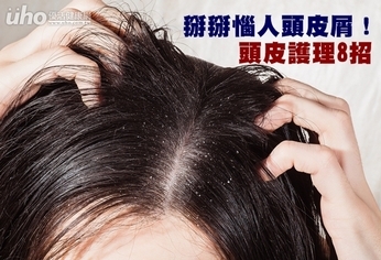 掰掰惱人頭皮屑!頭皮護理8招