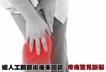嬤人工關節術後未回診 疼痛驚見斷裂