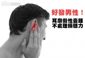 好發男性!耳廓假性囊腫不處理損聽力