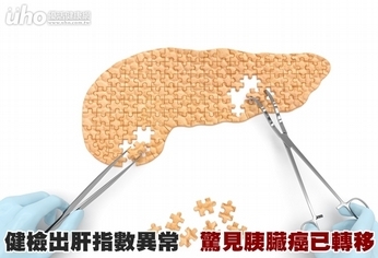 健檢出肝指數異常 驚見胰臟癌已轉移