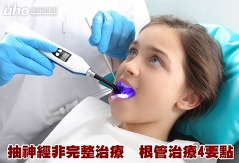 抽神經非完整治療 根管治療4要點