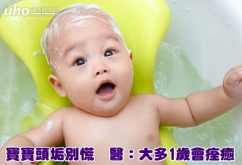 寶寶頭垢別慌 醫:大多1歲會痊癒