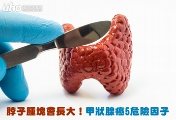 脖子腫塊會長大!甲狀腺癌5危險因子