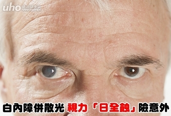 白內障併散光 視力「日全蝕」險意外