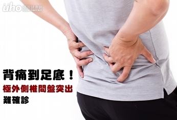 背痛到足底!極外側椎間盤突出難確診