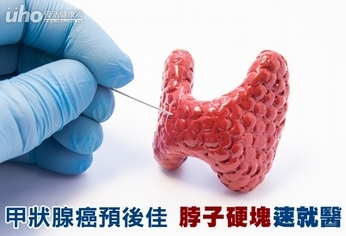 甲狀腺癌預後佳 脖子硬塊速就醫
