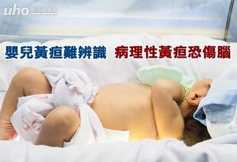 嬰兒黃疸難辨識 病理性黃疸恐傷腦