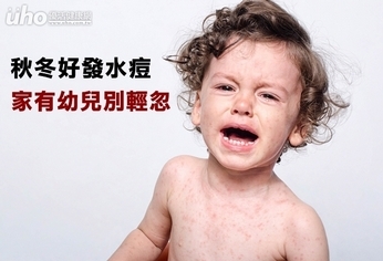 秋冬好發水痘 家有幼兒別輕忽