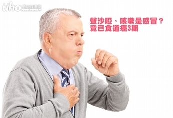 聲沙啞、咳嗽是感冒?竟已食道癌3期