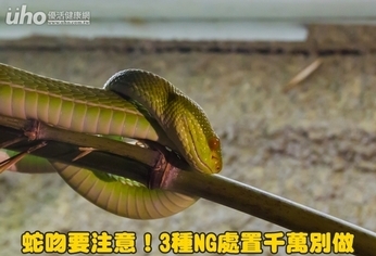 蛇吻要注意!3種NG處置千萬別做