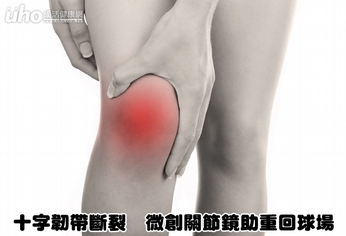 十字韌帶斷裂 微創關節鏡助重回球場
