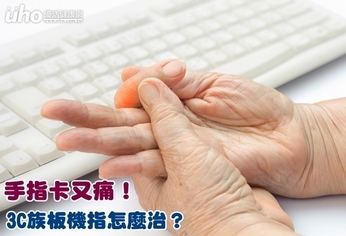 手指卡又痛!3C族板機指怎麼治?