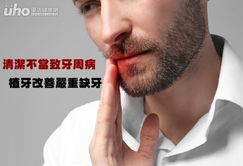 清潔不當致牙周病 植牙改善嚴重缺牙
