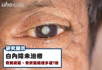 研究:白內障未治療 骨折風險增7成