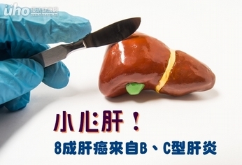 小心肝!8成肝癌來自B、C型肝炎