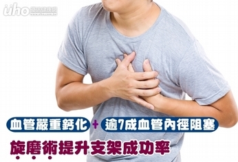 血管鈣化阻塞達7成 旋磨術助放支架
