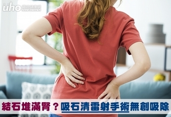 結石堆滿腎?吸石清雷射手術無創吸除