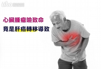 心臟腫瘤險致命 竟是肝癌轉移導致