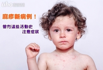 麻疹新病例!曾有這些活動史注意症狀