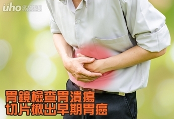 胃鏡檢查胃潰瘍 切片揪出早期胃癌