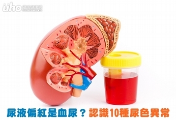 尿液偏紅是血尿?認識10種尿色異常