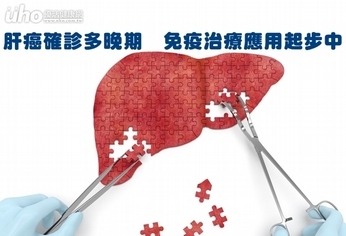 肝癌確診多晚期 免疫治療應用起步中