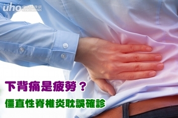 下背痛是疲勞?僵直性脊椎炎耽誤確診