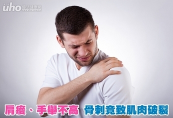 肩痠、手舉不高 骨刺竟致肌肉破裂