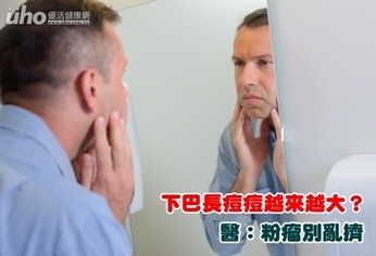 下巴長痘痘越來越大?醫:粉瘤別亂擠