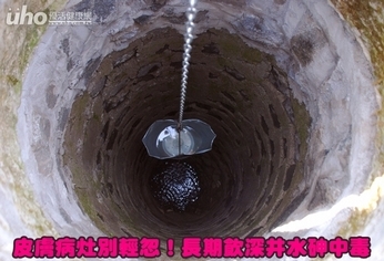 皮膚病灶別輕忽!長期飲深井水砷中毒