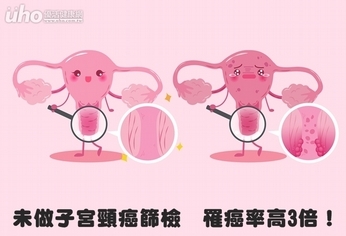 未做子宮頸癌篩檢 罹癌率高3倍!