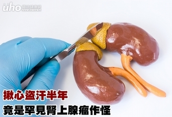 揪心盜汗半年 竟是罕見腎上腺瘤作怪