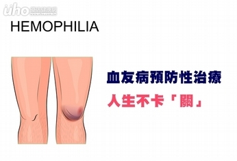 血友病預防性治療 人生不卡「關」