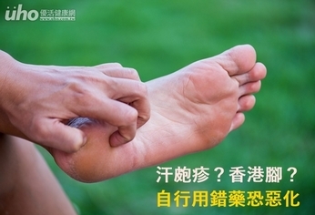 汗皰疹?香港腳?自行用錯藥恐惡化