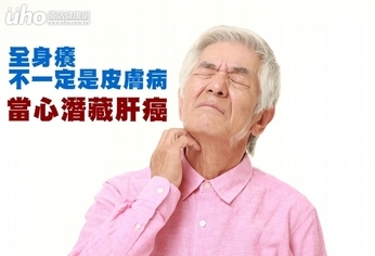 全身癢不一定是皮膚病 當心潛藏肝癌