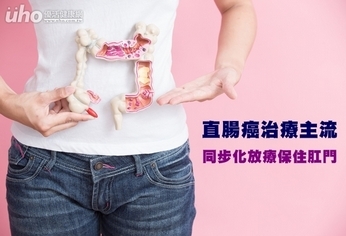 直腸癌治療主流 同步化放療保住肛門