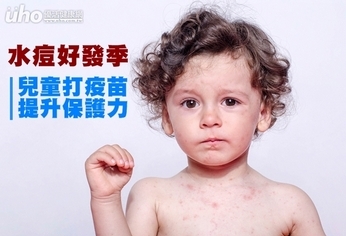 水痘好發季 兒童打疫苗提升保護力