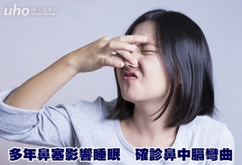 多年鼻塞影響睡眠 確診鼻中膈彎曲