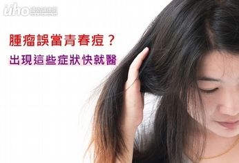 腫瘤誤當青春痘?出現這些症狀快就醫