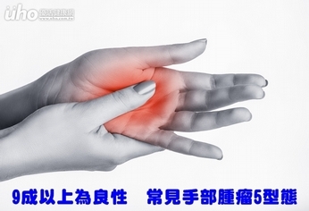 9成以上為良性 常見手部腫瘤5型態