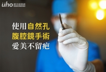 使用自然孔腹腔鏡手術,愛美不留疤