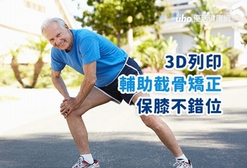 3D列印輔助截骨矯正 保膝不錯位