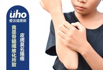 皮膚莫名搔癢 竟是骨髓纖維化所致!