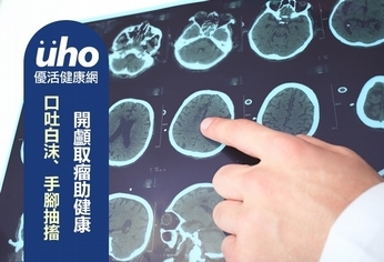 口吐白沫、手腳抽搐 開顱取瘤助健康