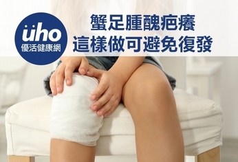 蟹足腫醜疤癢 這樣做可避免復發