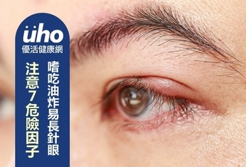 嗜吃油炸易長針眼 注意7危險因子