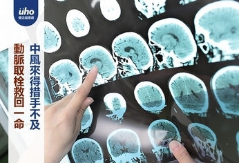 中風來得措手不及 動脈取栓救回一命