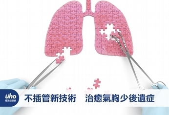 不插管新技術 治癒氣胸少後遺症